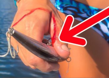 HUGE Heavy Duty Treble Hook BURIED in my Hand!