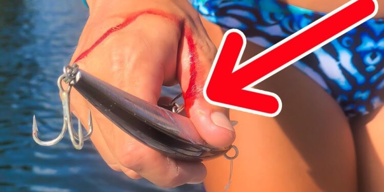 HUGE Heavy Duty Treble Hook BURIED in my Hand!