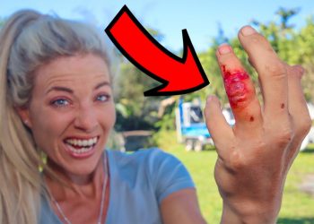 I Got a DEADLY Bacteria INFECTION on my Finger While Fishing! (Catch & Cook)