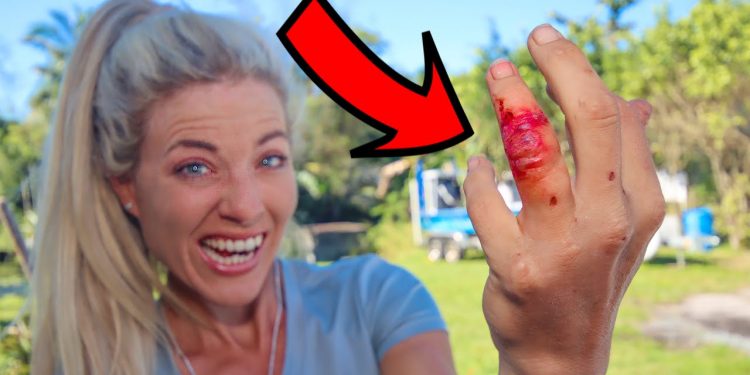 I Got a DEADLY Bacteria INFECTION on my Finger While Fishing! (Catch & Cook)